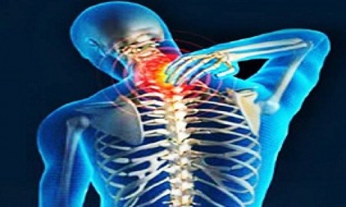 Cervical Spondylitis treatment