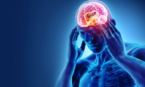 migraine  (माइग्रेन या सिरदर्द)