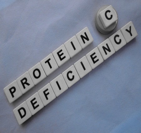 आएइ जाने की  प्रोटीन की कमी से क्या हानियां होती है