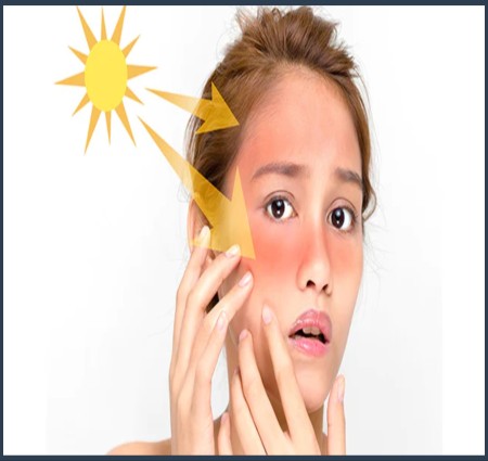 धूप में हम काले क्यों हो जाते हैं