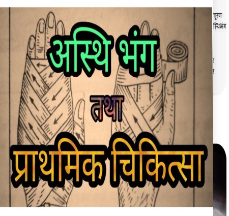 Vishisht angon ke asthi bhang mein prathmik chikitsa