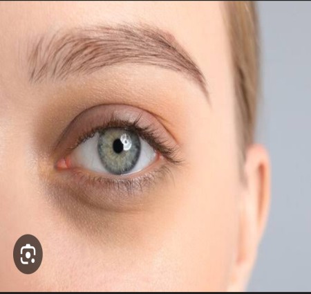 अगर आप भी आँखों के नीचे काले घेरे  (Dark Circles) से परेशान है तो ये नुस्खे जरूर ट्राय करें।