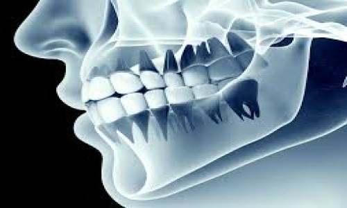 Dental X- Ray