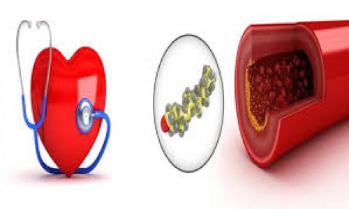 हार्ट अटैक  (cholesterol disorder) कोलेस्ट्रॉल विकार से