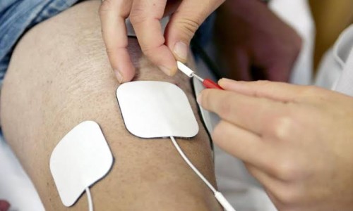 Electrical Stimulation