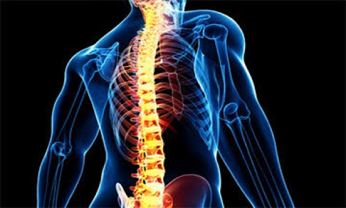 SPONDYLITIS(CERVICAL/LUMBAR)